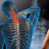Imagen de Almohada Nasa cervical NN2100 XL